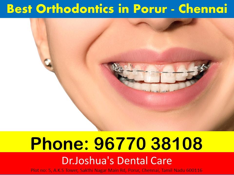 Orthodontics treatment in chennai